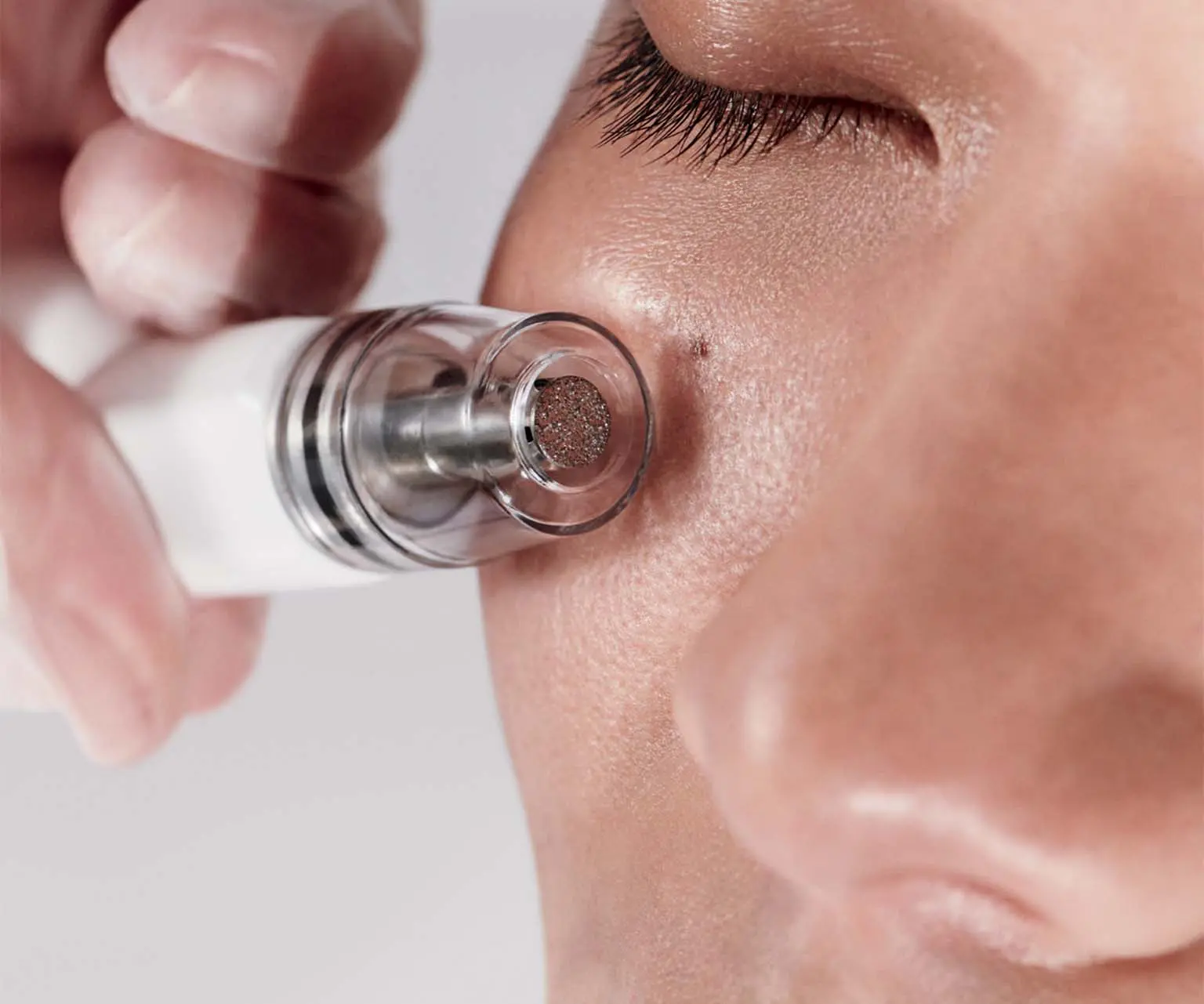 DiamondGlow resurfacing facial treatment at Moon Valley Med Spa in North Phoenix