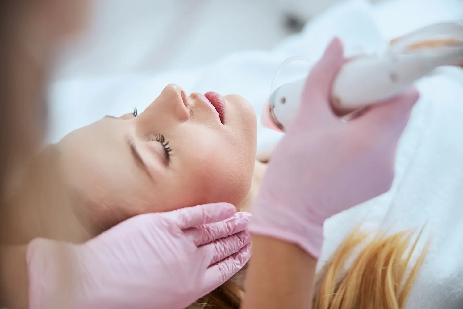 Microneedling treatment session at Moon Valley Med Spa