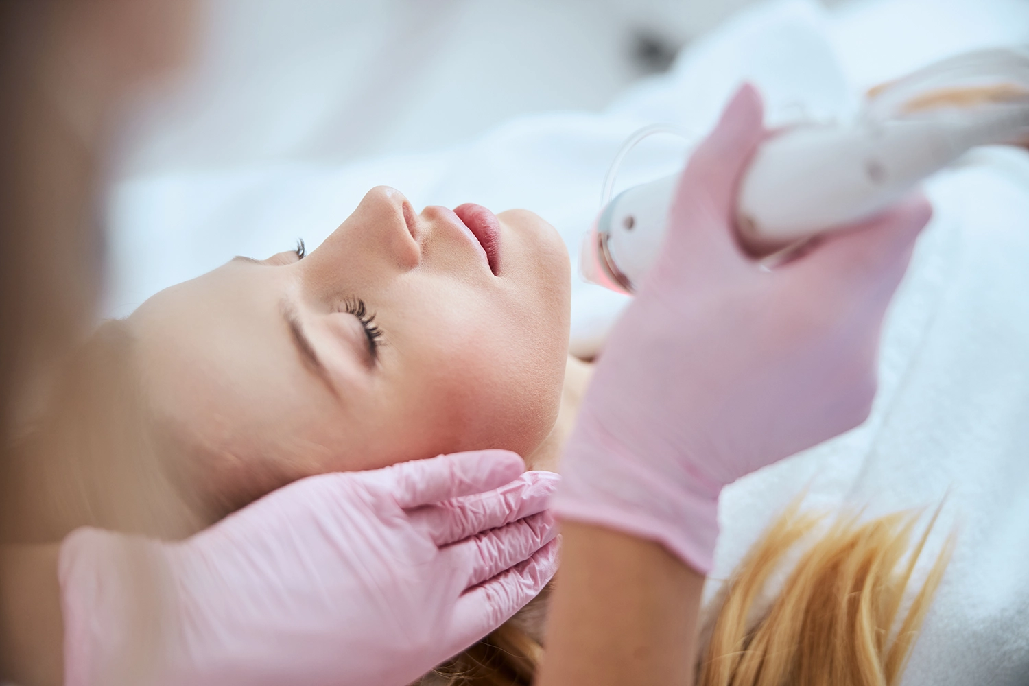 Microneedling treatment session at Moon Valley Med Spa