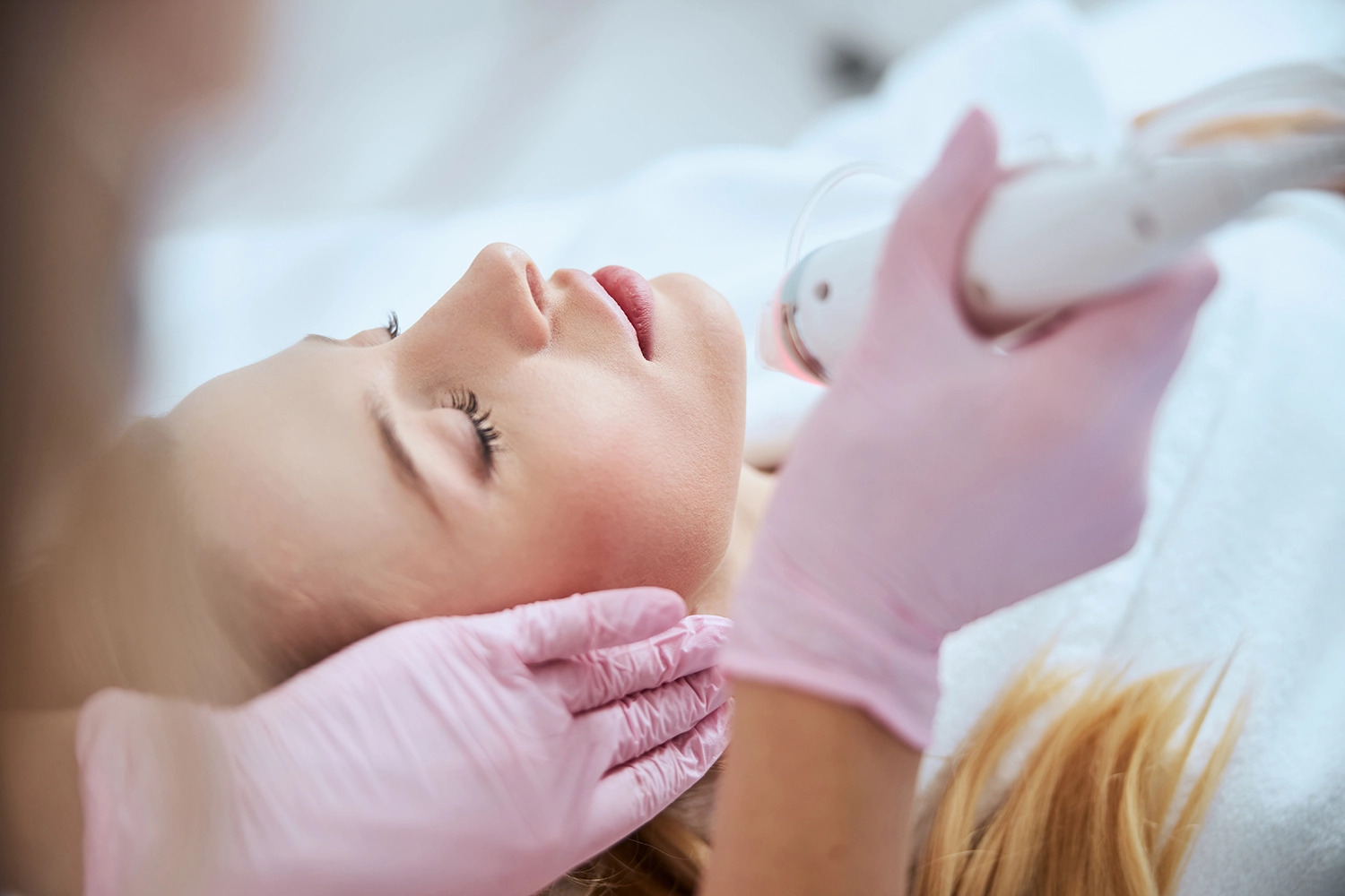 Cropped image of a doctor in latex gloves performing a fractional microneedling treatment on a blonde woman's face at Moon Valley Med Spa in Phoenix.