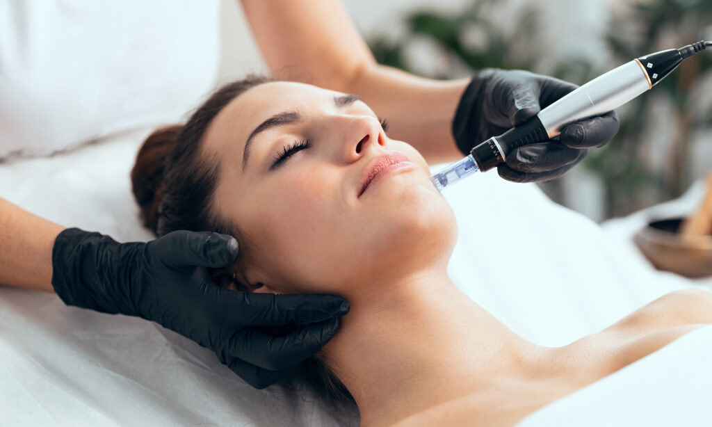 image of someone getting microneedling treatment