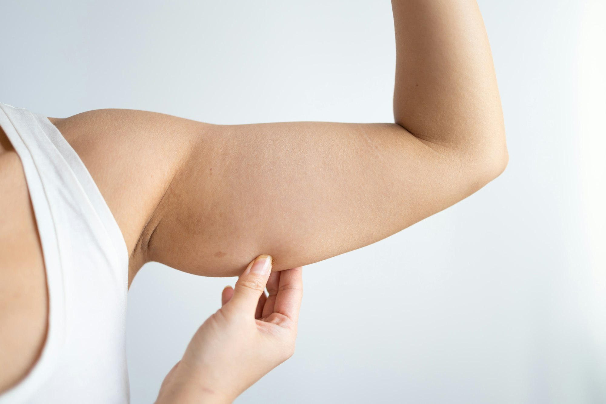 Cropped shot of a young woman with excess fat on her upper arm with marks for liposuction or plastic